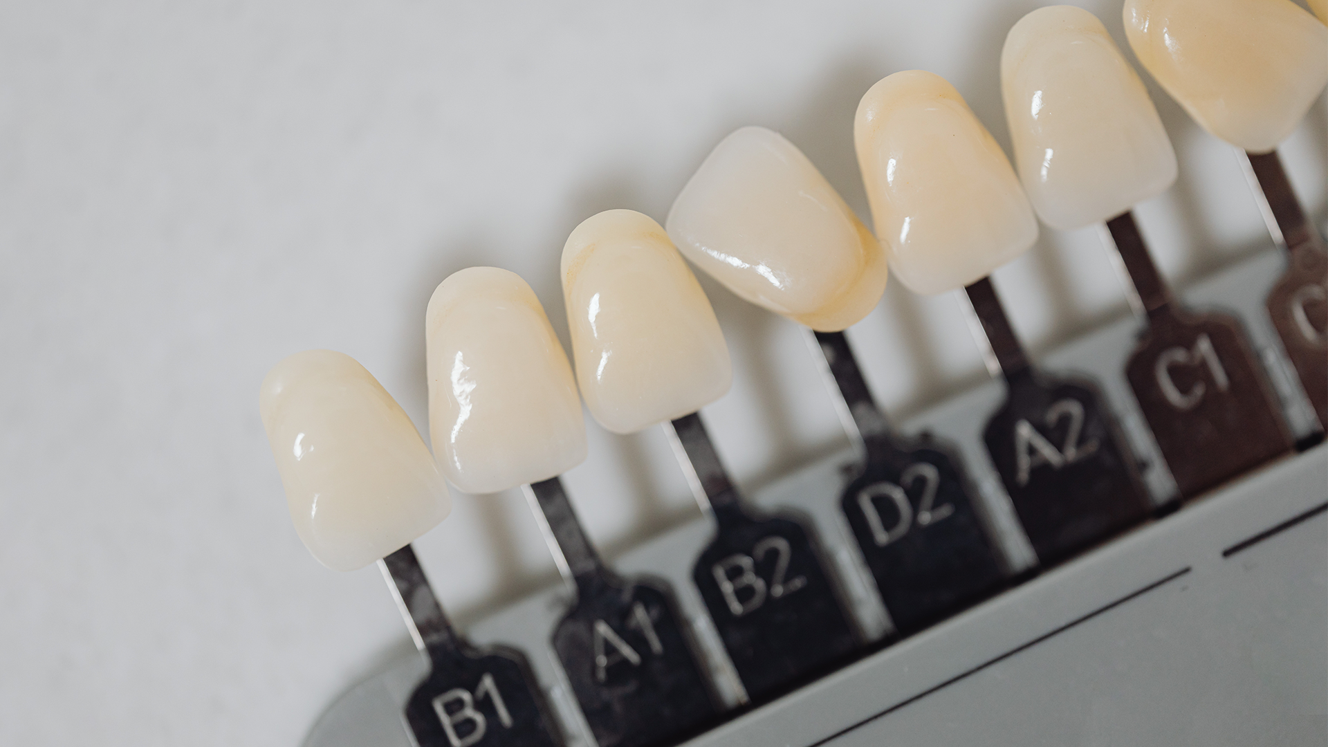 Reabilitação estética: o que precisa de saber Reabilitação estética: o que precisa de saber